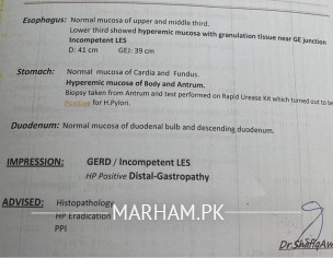 H Pylori Endoscopy.