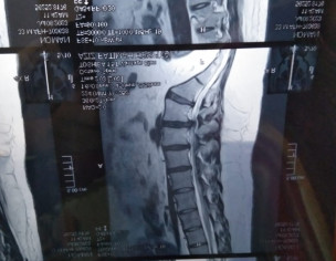 Disk Dislocated