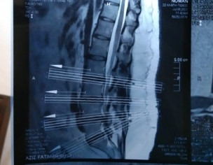 Disk Dislocated
