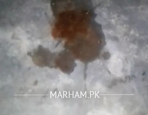 Blod Problm