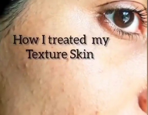 Skin Problem