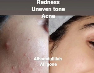 Skin Problem