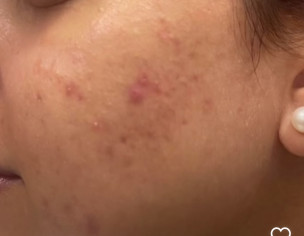 Skin Problem