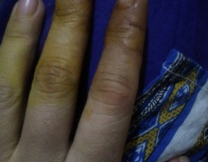 Cut From Knife