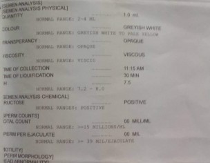 Azoospermia
