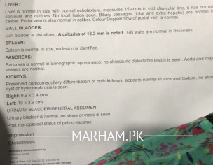 Gallbladerstone