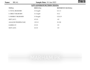 Doubt Liver Problem