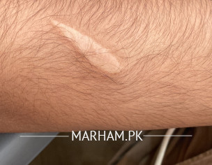 Blade Cut Mark