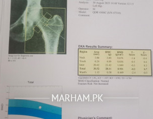 DEXA Scan