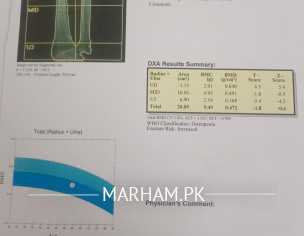 DEXA Scan