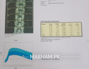 DEXA Scan