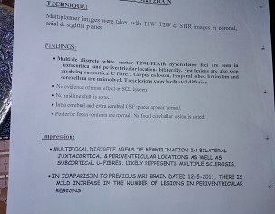 Neuro Problem