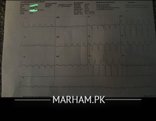 Heart Rate 