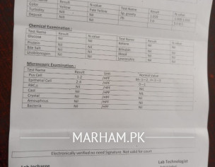 Check Urine Report