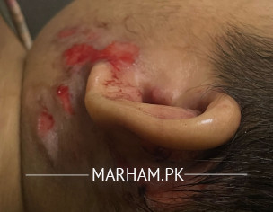Allergic, Kharish