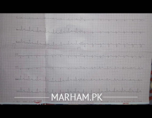 ECG Report Check