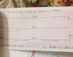 Angiogram Needed?