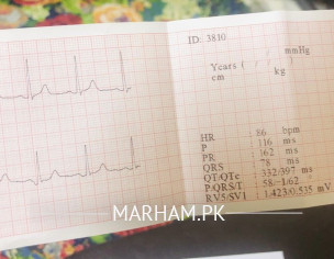 Angiogram Needed?