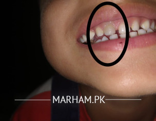 Teeth