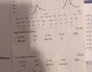 Ears Hearing Loss