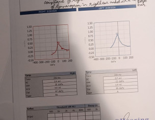 Ears Hearing Loss