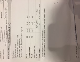 Baby’s Kidneys Not Developed 