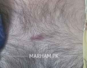 Skin Problem