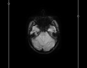 Neurological