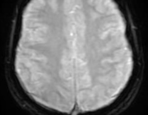 Neurological