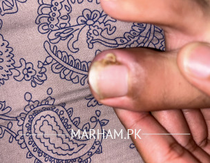 Ingrowing Toe Nail