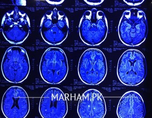 Neurology