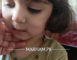 Dent On The Cheek