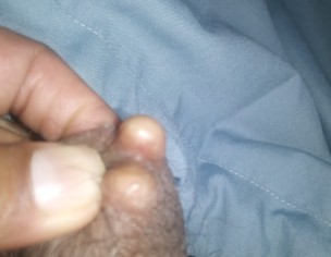 Testicles 