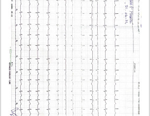 Seeing Some Heart Issue