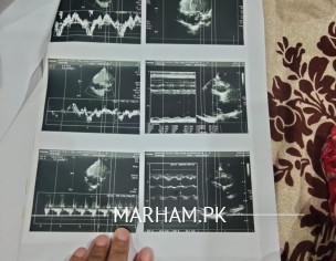 Heart Issue