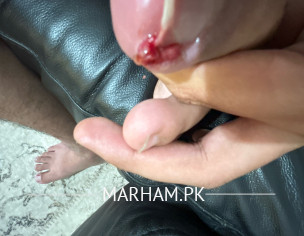 Toe Nail Infection 