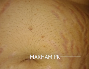 Skin Problem
