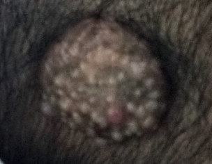 Skin Problem