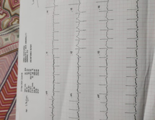 Fast Heart Rate
