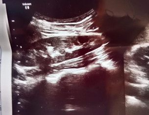 Polyuria Problem