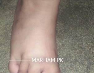 Feet Problem