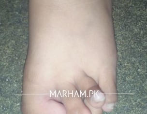 Feet Problem