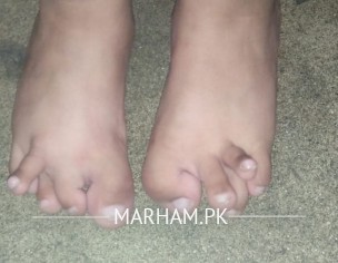 Feet Problem