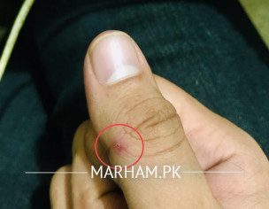 Skin Problem