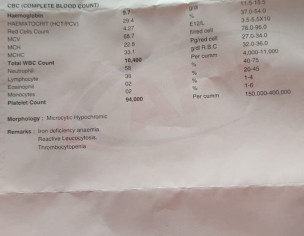 Platelets Issues