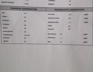 Urine Test