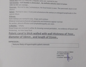Due To Vomiting