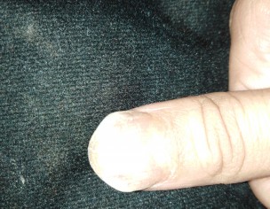 Nail Problem