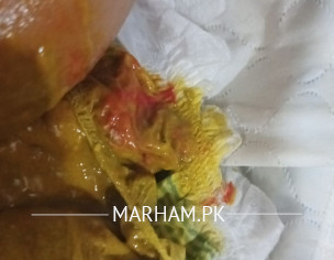 Blood In Stool