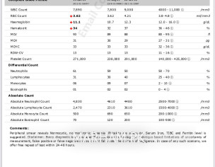 High Ferritin Level